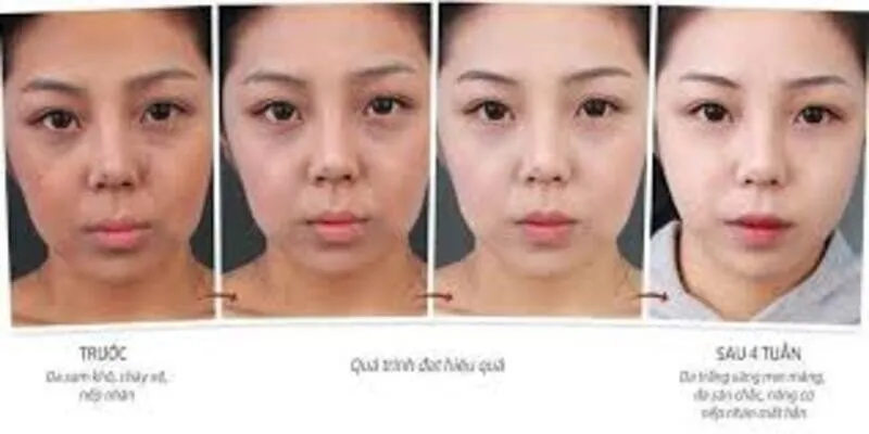 Bí quyết làm đẹp da sạm – khô – nhăn cho phái nữ 35+